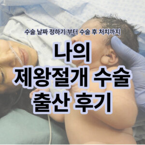 제왕절개