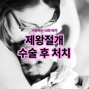 제왕절개